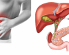 Tìm hiểu về sỏi mật 