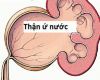 Sỏi gây thận ứ nước độ 1 liệu có chữa khỏi được không?