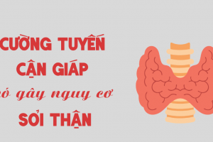 BỆNH CƯỜNG TUYẾN CẬN GIÁP – YẾU TỐ NGUY CƠ ÍT BIẾT CỦA SỎI THẬN