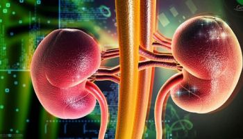 Trị sỏi đúng cách không cần phẫu thuật