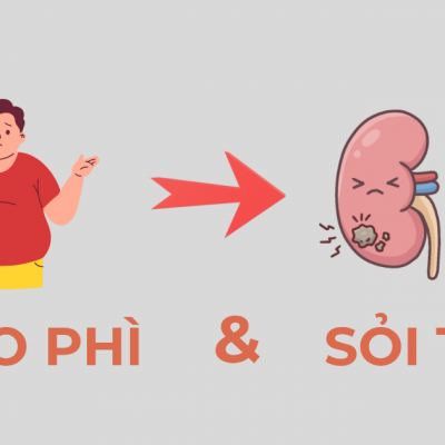 Béo phì và nguy cơ sỏi thận